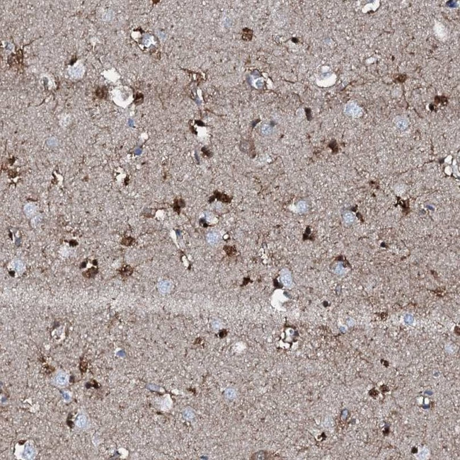 GFOD2 Antibody in Immunohistochemistry (IHC)