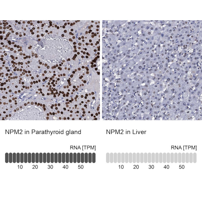 NPM2 Antibody in Immunohistochemistry (IHC)