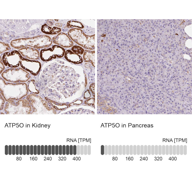 ATP Synthase O Antibody in Immunohistochemistry (IHC)