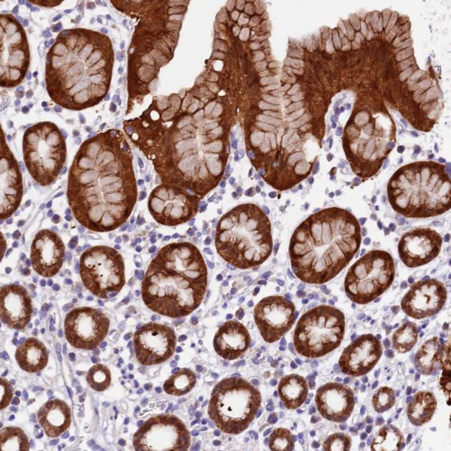 DDX28 Antibody in Immunohistochemistry (Paraffin) (IHC (P))