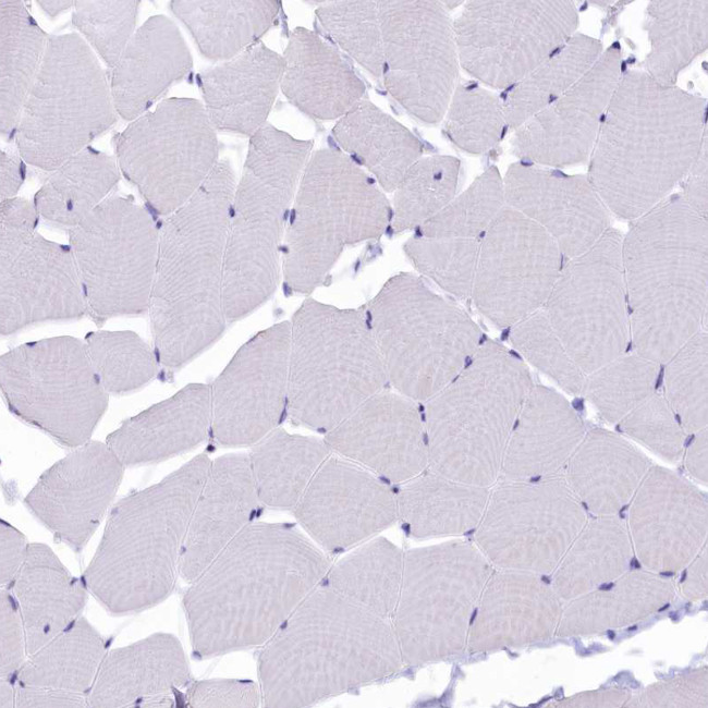 SOD3 Antibody in Immunohistochemistry (IHC)