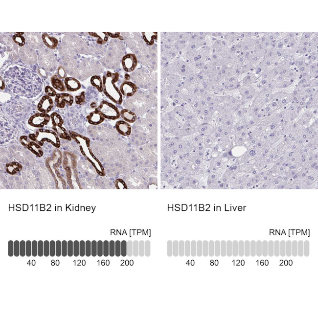 HSD11B2 Antibody in Immunohistochemistry (IHC)