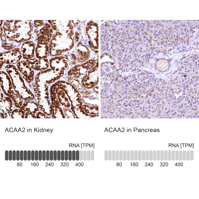 ACAA2 Antibody in Immunohistochemistry (IHC)