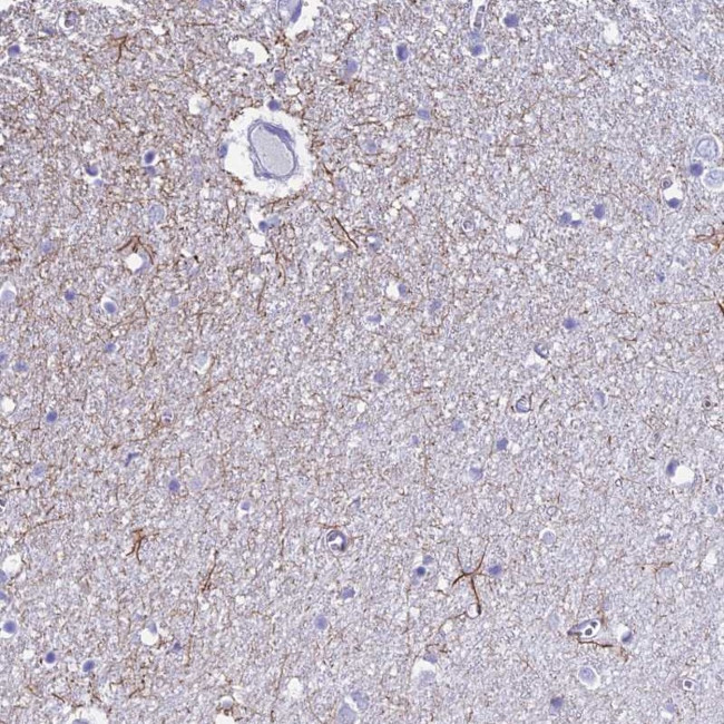 UNC80 Antibody in Immunohistochemistry (IHC)