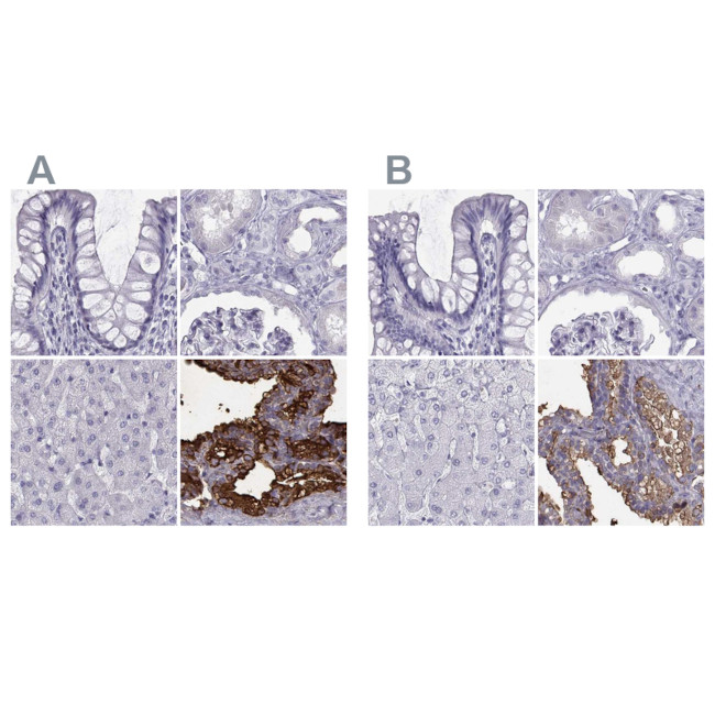 SEMG1 Antibody in Immunohistochemistry (IHC)