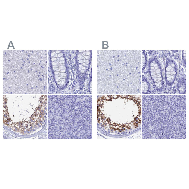 TEX101 Antibody in Immunohistochemistry (IHC)