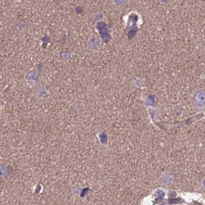 DUS2L Antibody in Immunohistochemistry (IHC)