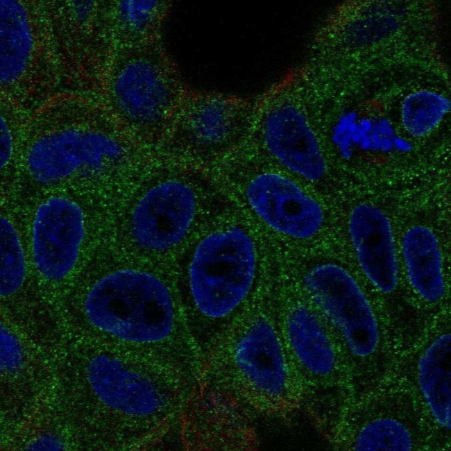 VKORC1 Antibody in Immunocytochemistry (ICC/IF)