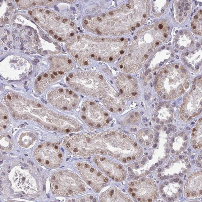 POP4 Antibody in Immunohistochemistry (IHC)