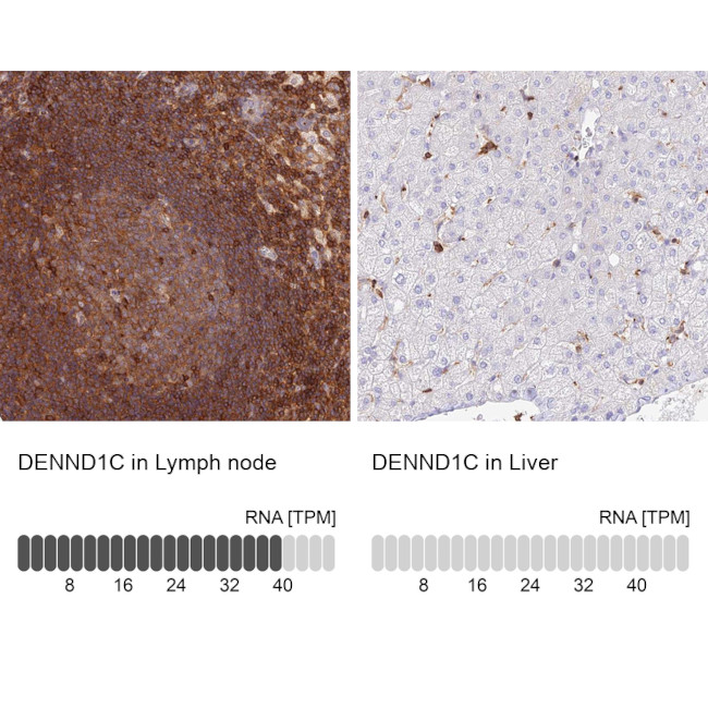 DENND1C Antibody in Immunohistochemistry (IHC)