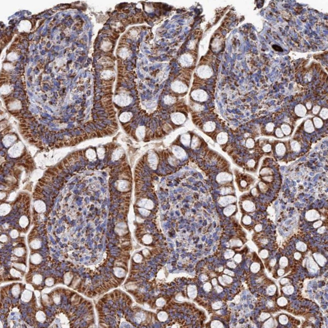 Aquaporin 11 Antibody in Immunohistochemistry (Paraffin) (IHC (P))