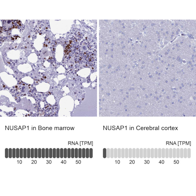 NUSAP1 Antibody in Immunohistochemistry (IHC)