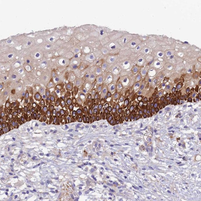 CCDC157 Antibody in Immunohistochemistry (Paraffin) (IHC (P))