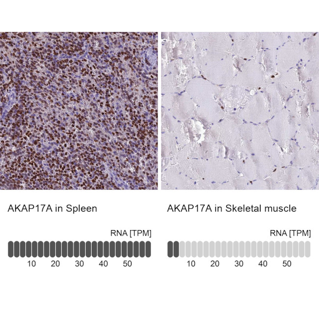 AKAP17A Antibody in Immunohistochemistry (IHC)