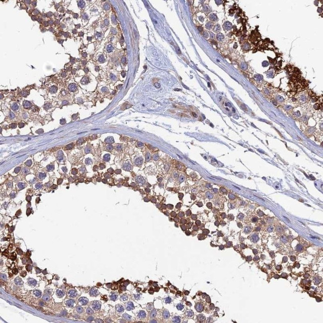 KIAA1211 Antibody in Immunohistochemistry (IHC)