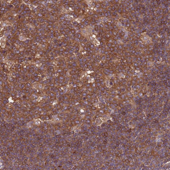 ATXN2L Antibody in Immunohistochemistry (Paraffin) (IHC (P))