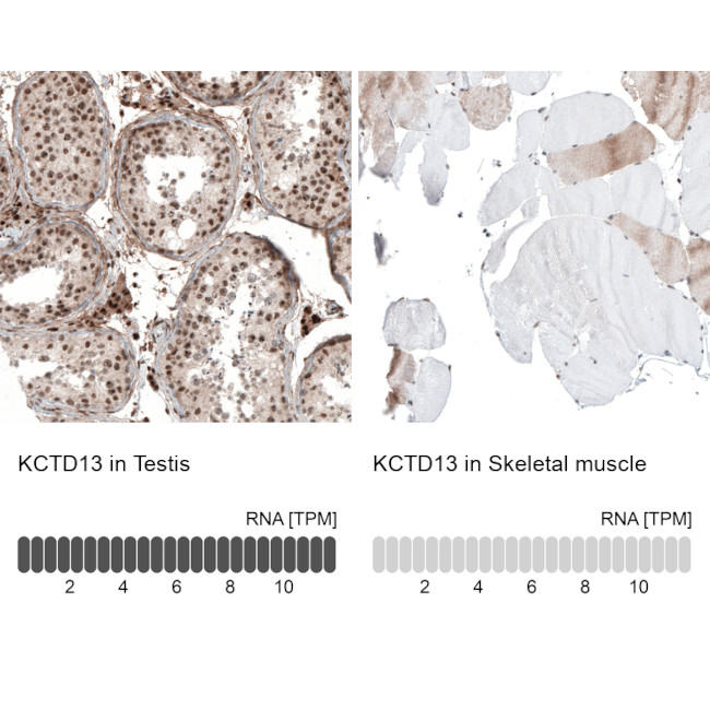 KCTD13 Antibody in Immunohistochemistry (IHC)