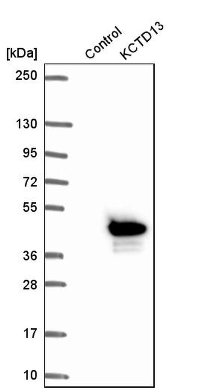 KCTD13 Antibody in Western Blot (WB)