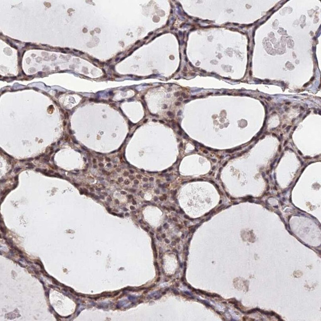 PAGR1 Antibody in Immunohistochemistry (IHC)