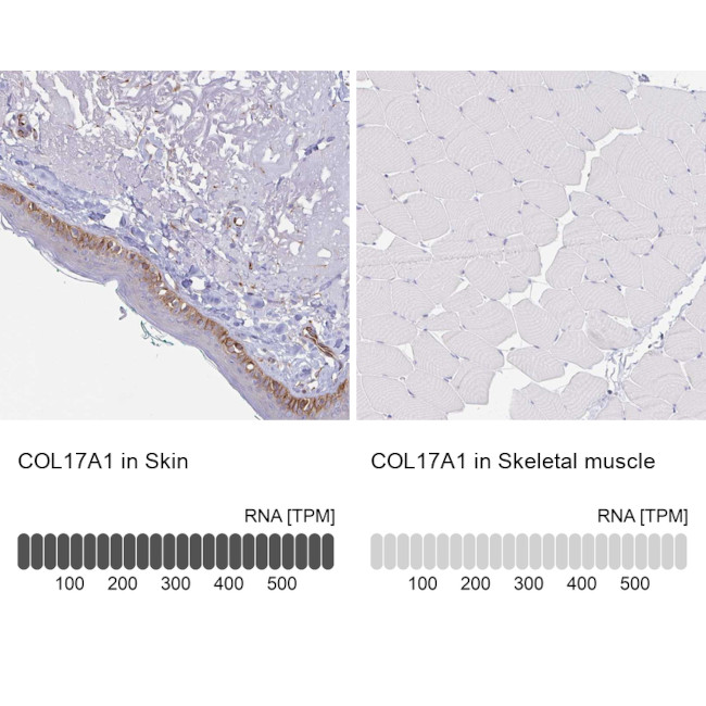 COL17A1 Antibody in Immunohistochemistry (IHC)