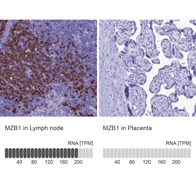 MZB1 Antibody in Immunohistochemistry (IHC)