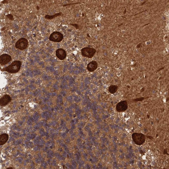 ABH1 Antibody in Immunohistochemistry (Paraffin) (IHC (P))