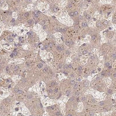 PSMD9 Antibody in Immunohistochemistry (IHC)