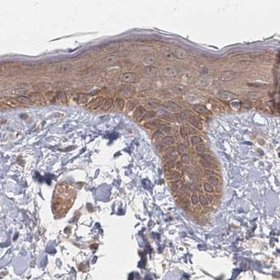 PSMD9 Antibody in Immunohistochemistry (IHC)