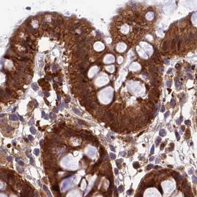 MKKS Antibody in Immunohistochemistry (IHC)