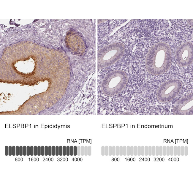 ELSPBP1 Antibody in Immunohistochemistry (IHC)