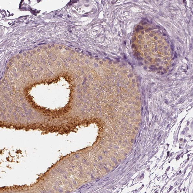 ELSPBP1 Antibody in Immunohistochemistry (IHC)