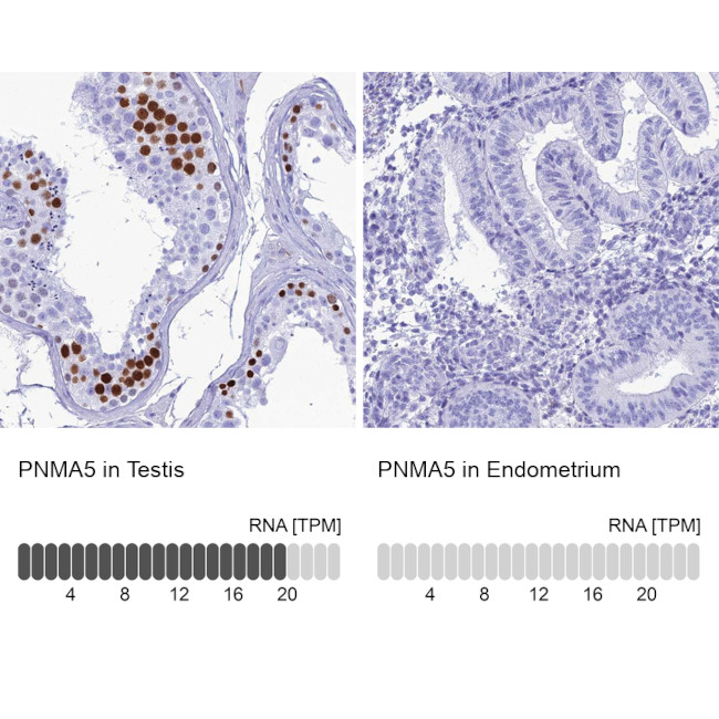 PNMA5 Antibody in Immunohistochemistry (IHC)