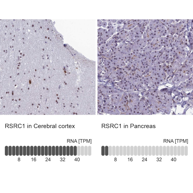 RSRC1 Antibody in Immunohistochemistry (IHC)