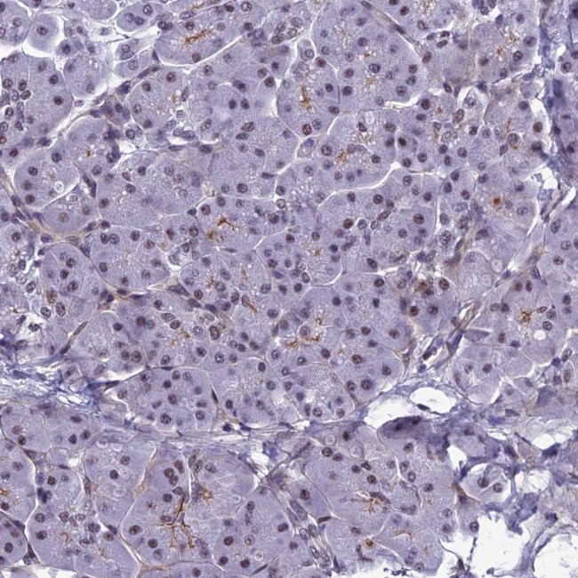 RSRC1 Antibody in Immunohistochemistry (IHC)