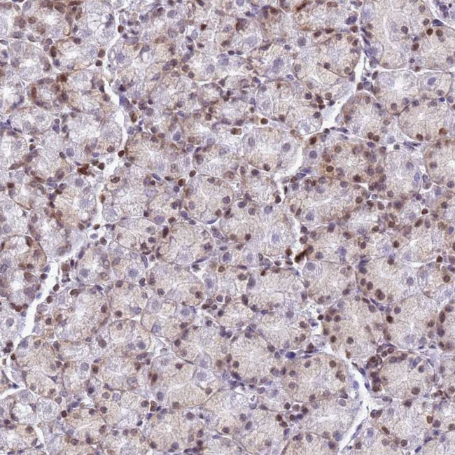 MYEOV2 Antibody in Immunohistochemistry (Paraffin) (IHC (P))