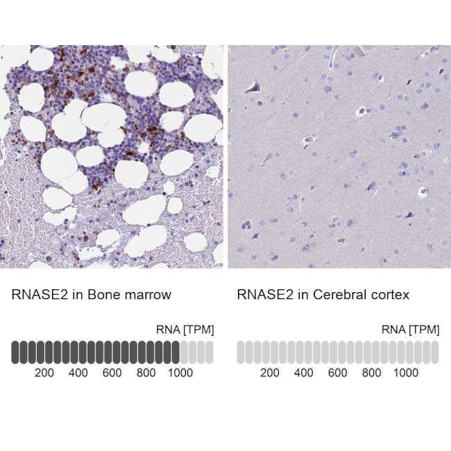 RNASE2 Antibody in Immunohistochemistry (IHC)