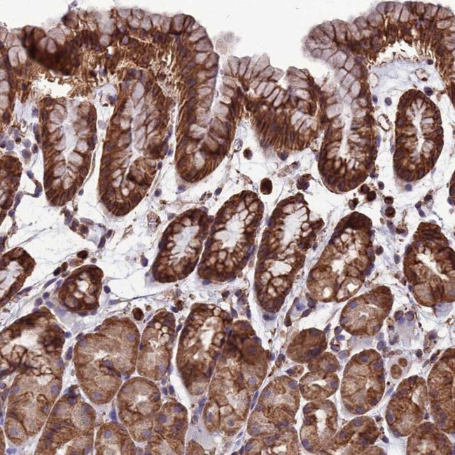 LSM6 Antibody in Immunohistochemistry (IHC)