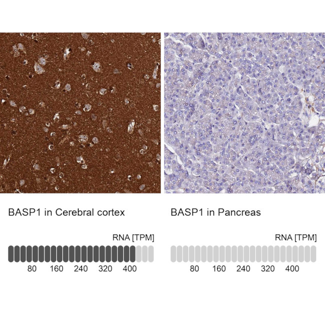 BASP1 Antibody in Immunohistochemistry (IHC)
