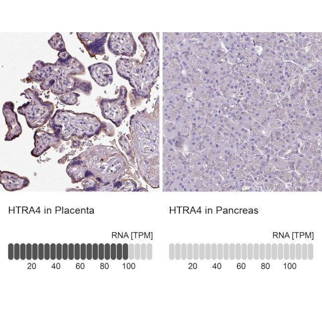 HTRA4 Antibody in Immunohistochemistry (IHC)