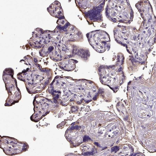 HTRA4 Antibody in Immunohistochemistry (IHC)