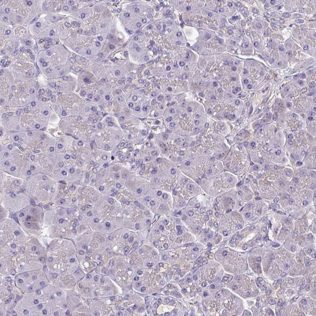 HTRA4 Antibody in Immunohistochemistry (IHC)