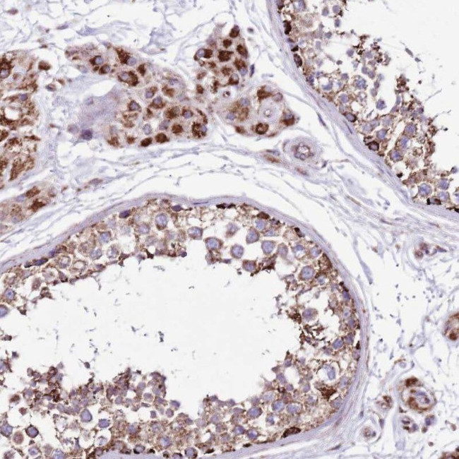 HECTD4 Antibody in Immunohistochemistry (IHC)