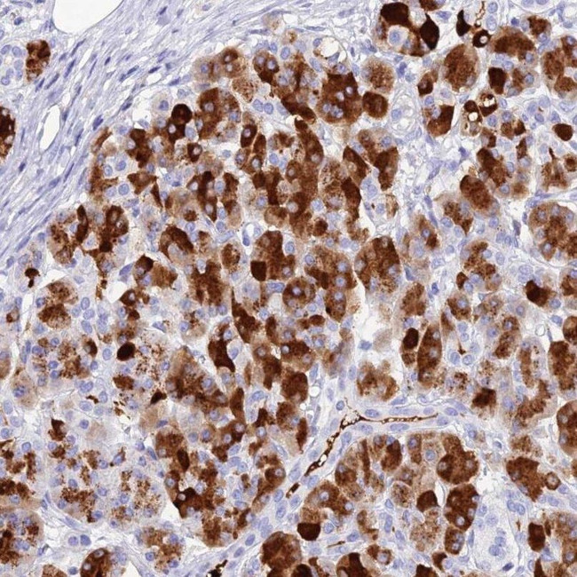 ELA3A Antibody in Immunohistochemistry (IHC)