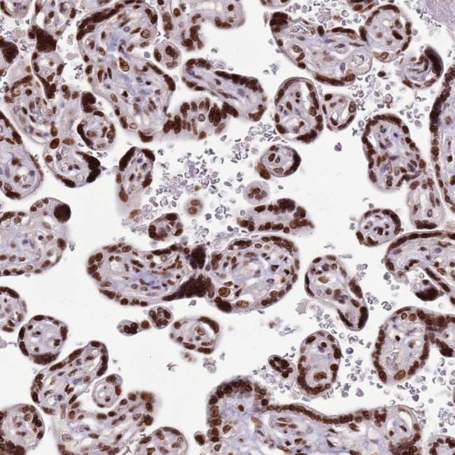 KIAA1033 Antibody in Immunohistochemistry (IHC)