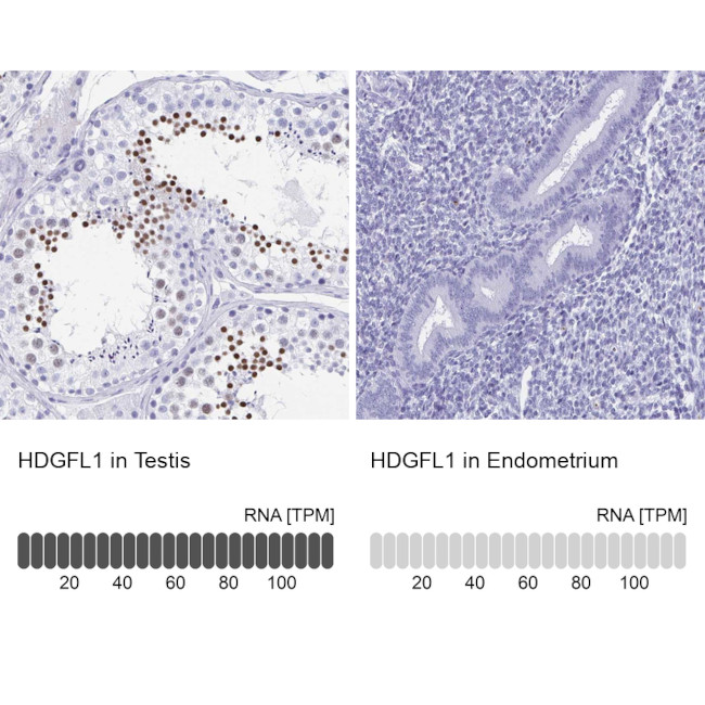 HDGFL1 Antibody in Immunohistochemistry (IHC)