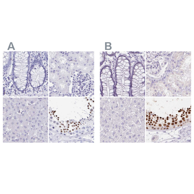 HDGFL1 Antibody in Immunohistochemistry (IHC)