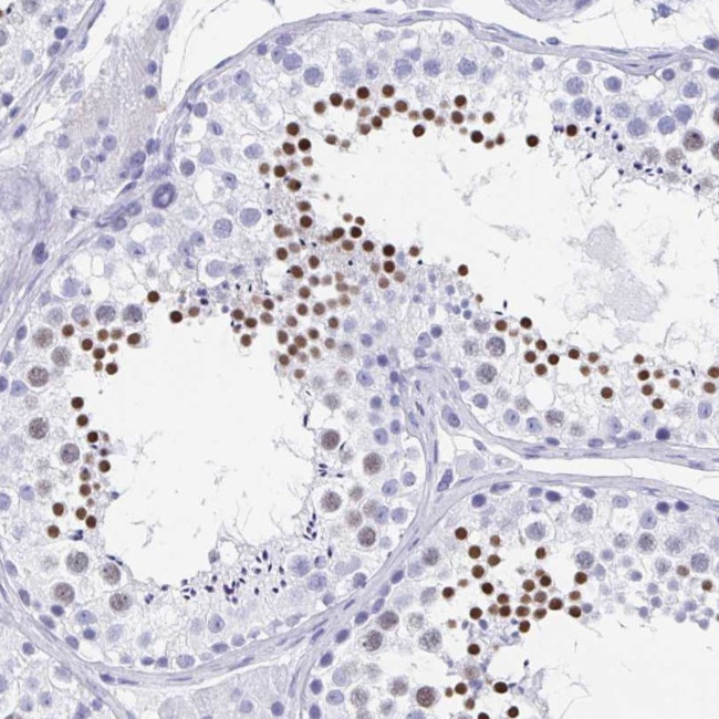 HDGFL1 Antibody in Immunohistochemistry (IHC)