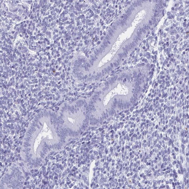 HDGFL1 Antibody in Immunohistochemistry (IHC)