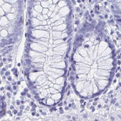 HDGFL1 Antibody in Immunohistochemistry (IHC)