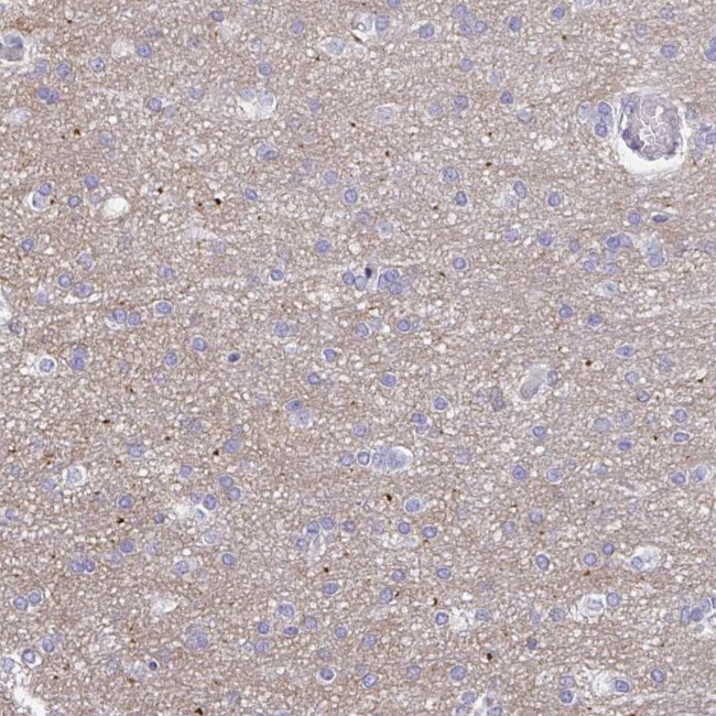 HAPLN2 Antibody in Immunohistochemistry (IHC)